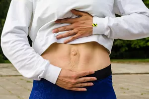 Woman revealing diastasis recti
